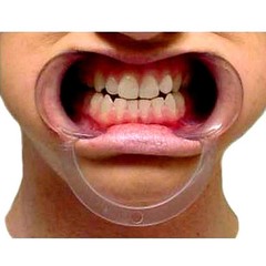 20pc S/M/L Dental Mouth Opener Lip Cheek Retractor C-Shape Adult Kid YA Game